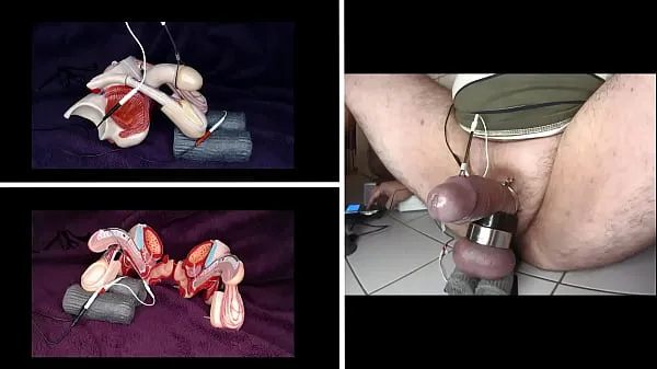 Prikaži electrical stimulation of the testicles skupaj filmov